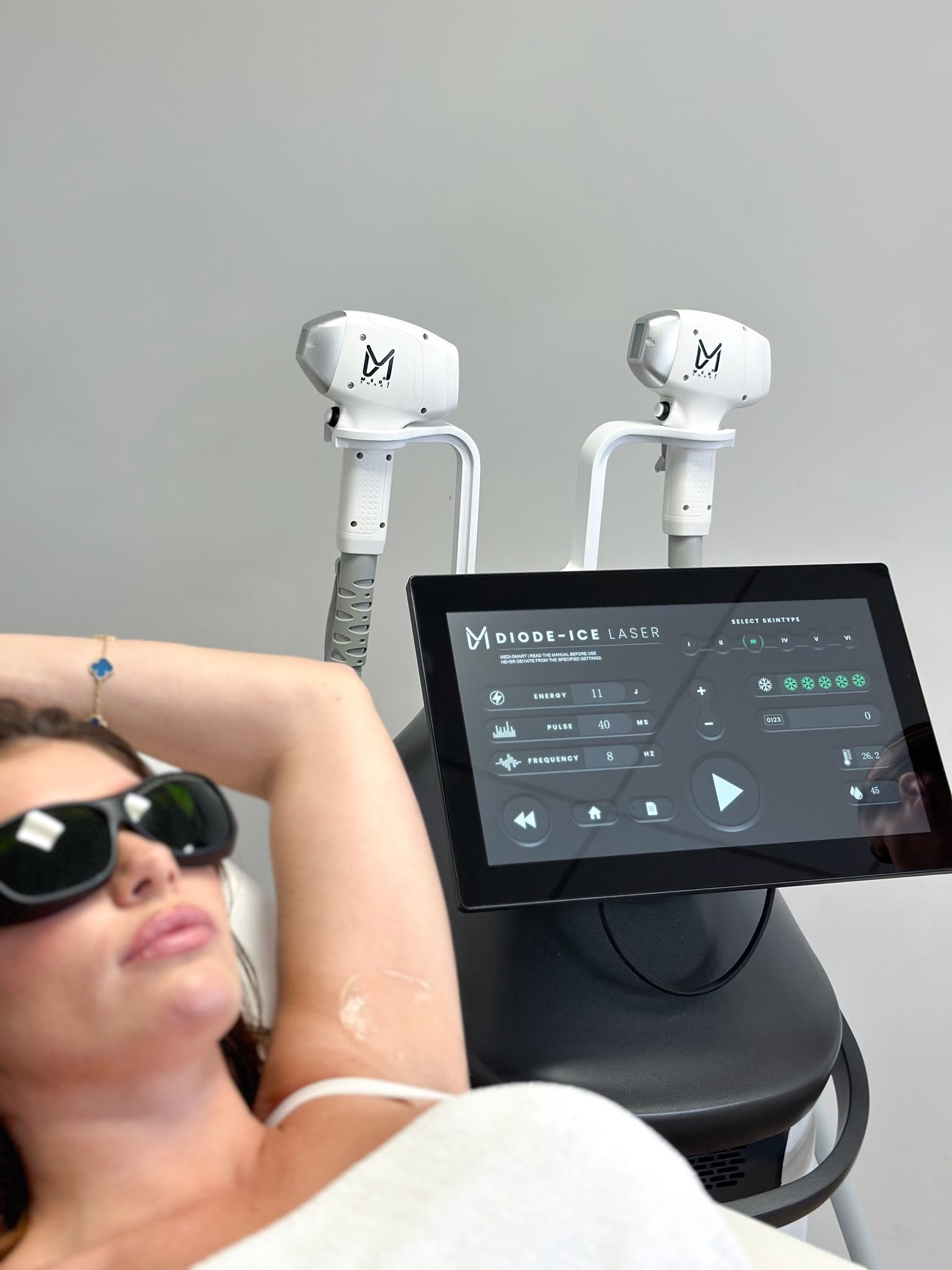 Laserontharing Maasbree bij Nicole Care & Beauty in Maasbree
