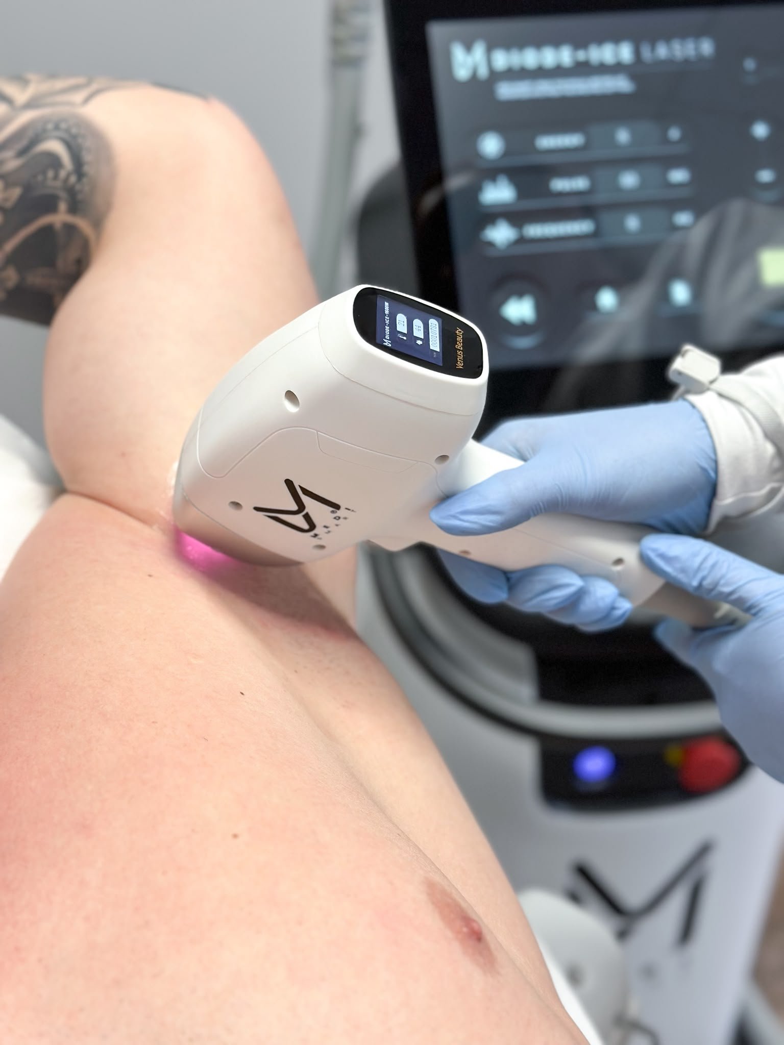Medi-Smart Quattro Wave Diode Ice Laser apparaat in salon Maasbree